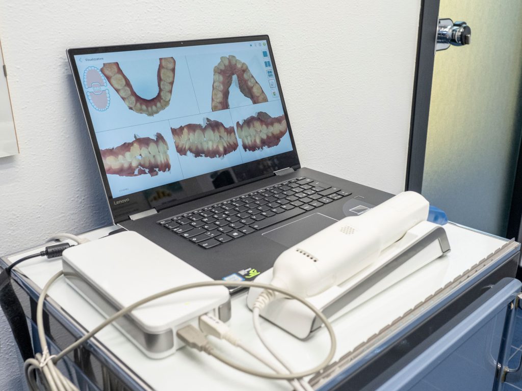 Scanner 3D